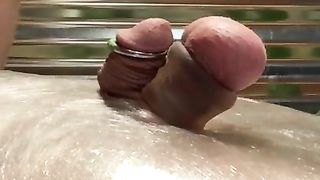 CBT: Stinging Nettles + TENS Unit = Amazing CBT Fun!