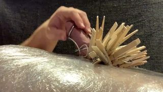 CBT: Clothespins and TENS