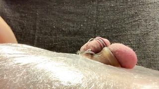 CBT: Clothespins and TENS