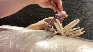 CBT: Clothespins and TENS