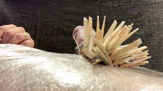 CBT: Clothespins and TENS