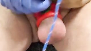 CBT: Playing with Stinging Nettles