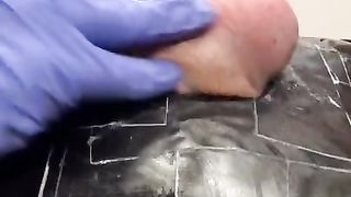 CBT: IcyHot + Stinging Nettles