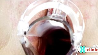 Lezdom Nurse uses Gyno Tools and Toys on her Patient