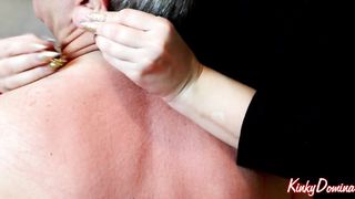 Red Marks After Back Scratching