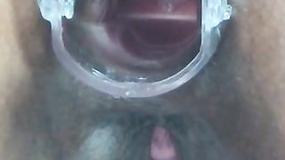 expanding my asshole