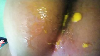 #3.⭐JUICY MANGO RIGHT INTO MY GORGEOUS ASS°NASTY°