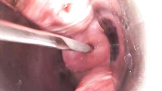 Extreme Cervix Penetration, Sounds, Speculum, Uterus Dilation