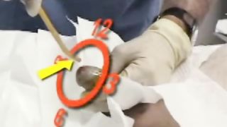 Catherisation for BDSM Play