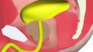 Catherisation for BDSM Play